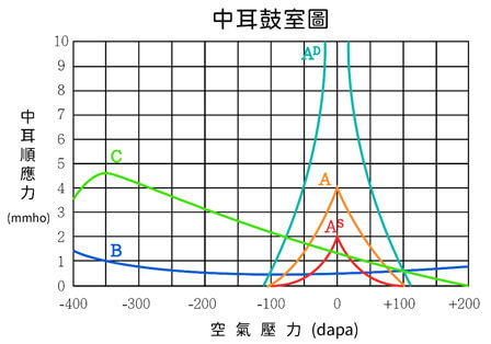 中耳鼓室檢查後的報告圖