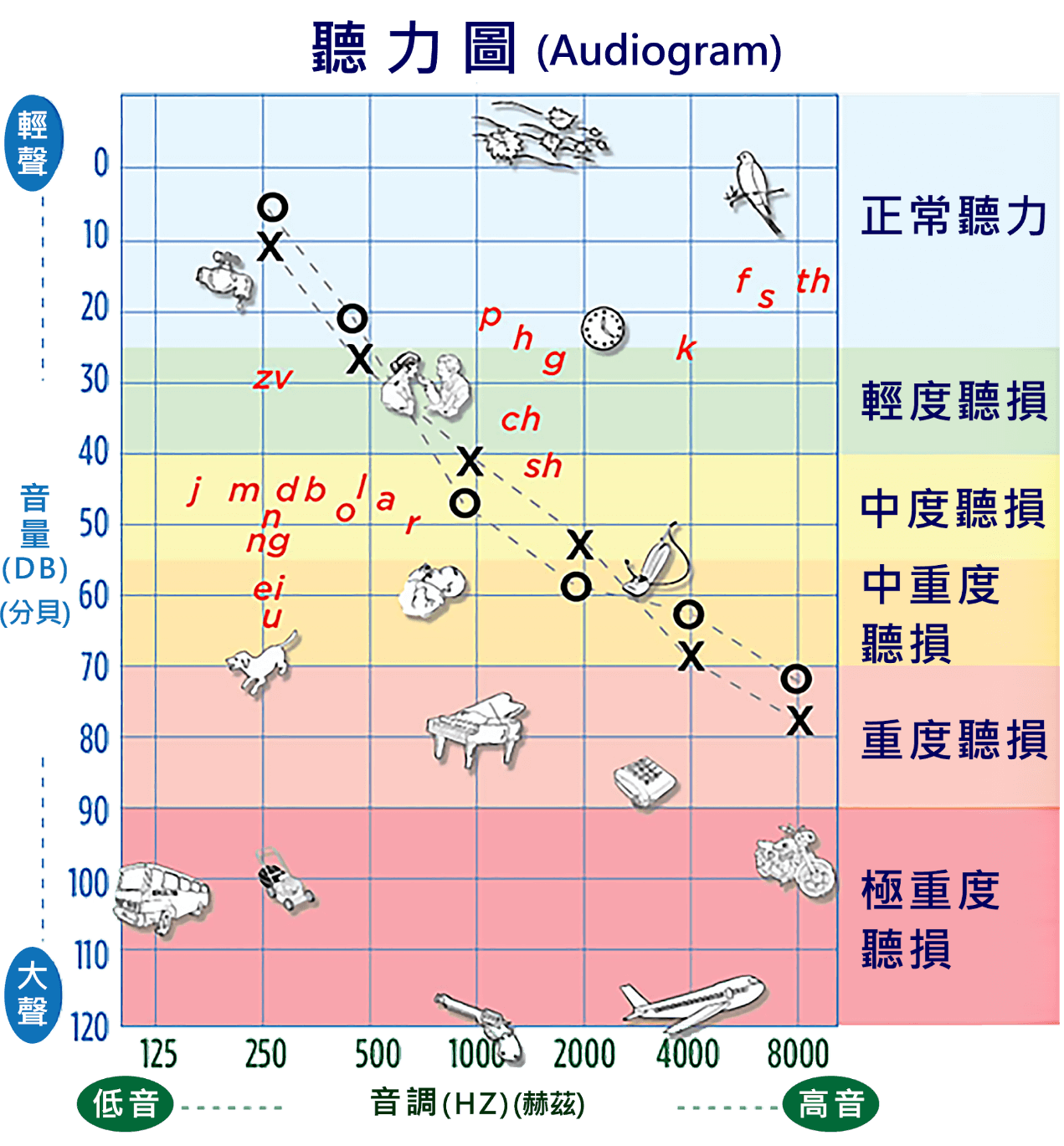 聽力圖與左右耳聽力、聽力損失分級示意圖