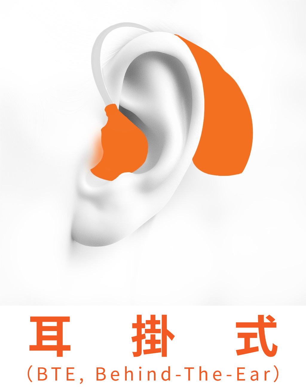 耳掛型助聽器（BTE）