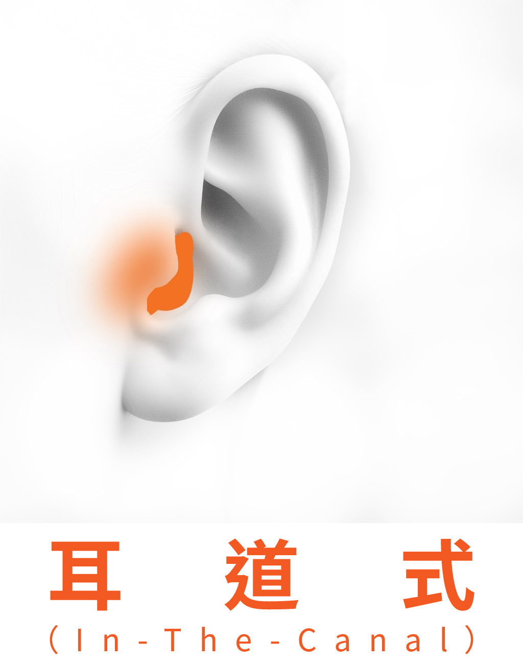 耳道型助聽器（CIC/ITC）