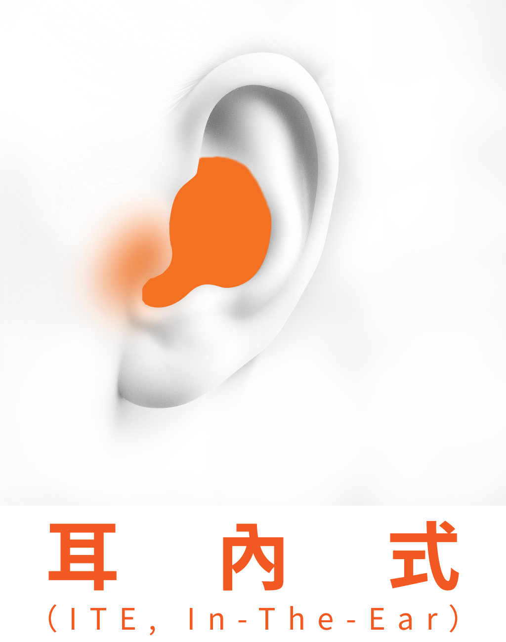 耳內型助聽器（ITE）