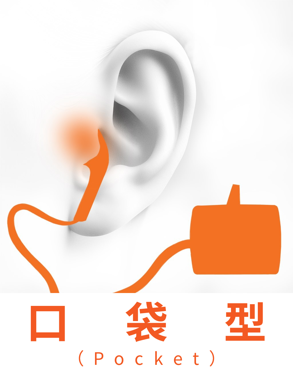 口袋型助聽器